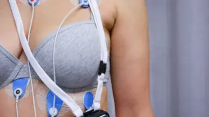 Holter electrocardiográfico ECG: lo que debes saber sobre esta prueba - Adeslas Salud y Bienestar