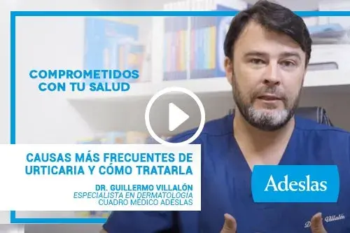 Urticaria | Videopost del Dr. Guillermo Villalón