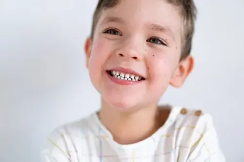 ¿Es posible que mi hijo no pierda nunca los dientes de leche?